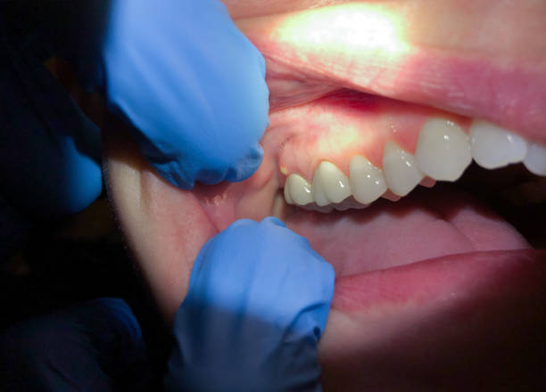 Best Emergency Treatment for Jaw Pain or Injury in New Franklin, MO