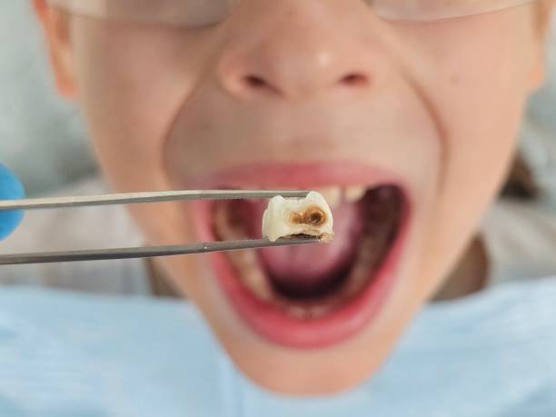 Best Emergency Care for Gum Disease in New Franklin, MO